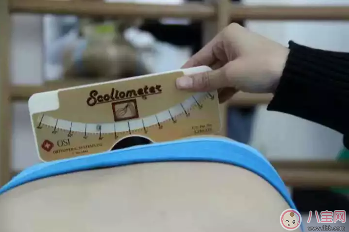 孩子脊柱側彎嚴重嗎 孩子脊柱側彎怎么治