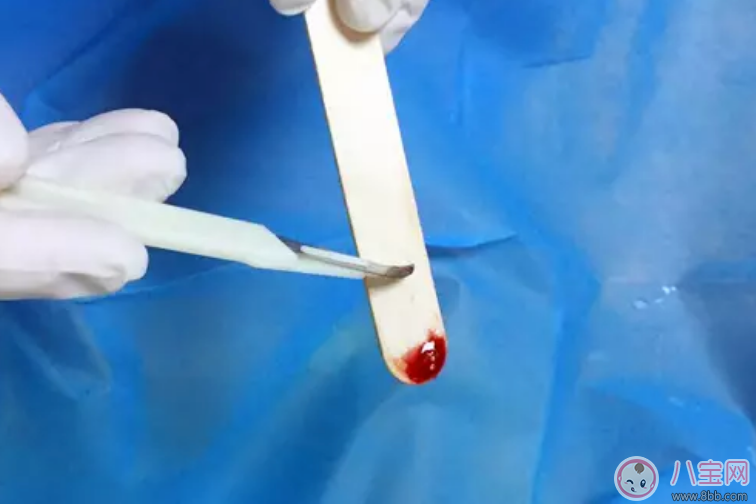 如何用中醫(yī)看扁桃體發(fā)炎 扁桃體炎中醫(yī)的啄治療法怎么樣 如何用中醫(yī)看扁桃體發(fā)炎 扁桃體炎中醫(yī)的啄治療法怎么樣