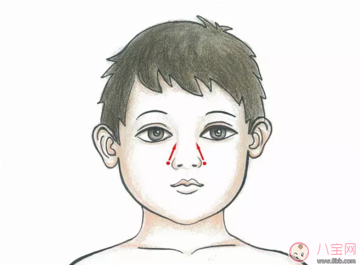 小兒扁桃體反復腫大發燒如何推拿 怎么推拿治療寶寶扁桃體發炎疼痛 小兒扁桃體反復腫大發燒如何推拿 怎么推拿治療寶寶扁桃體發炎疼痛