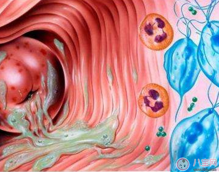 宮頸糜爛治好了還能順產生孩子嗎 宮頸糜爛對生寶寶有哪些影響