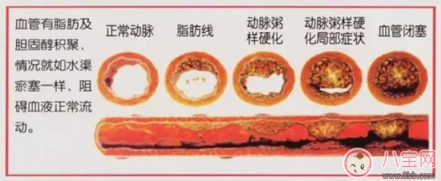 媽媽陪孩子寫作業擔心心梗怎么辦 怎么讓自己不擔心被氣到