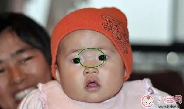 新生兒鼻梁上有青筋會(huì)難養(yǎng)嗎 剛出世不久的小孩鼻梁上有青筋會(huì)自己好嗎