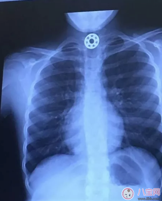 指尖陀螺孩子玩安全嗎 為什么指尖陀螺不能給孩子玩 指尖陀螺孩子玩安全嗎 為什么指尖陀螺不能給孩子玩