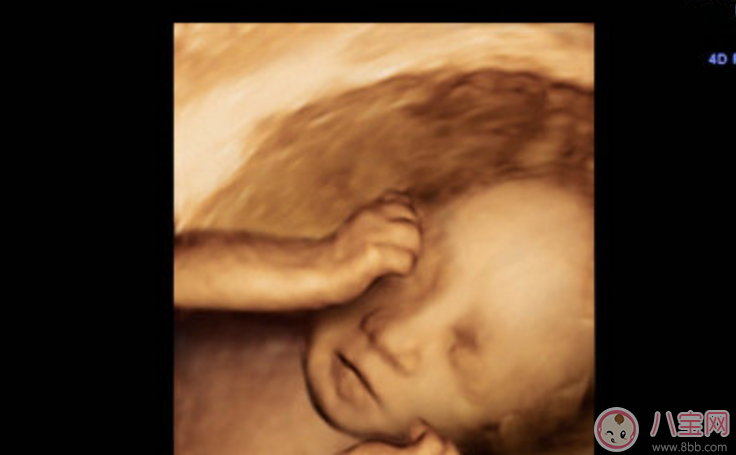寶寶在媽媽肚子里就會哭了嗎 胎兒在肚子里哭是怎么回事 寶寶在媽媽肚子里就會哭了嗎 胎兒在肚子里哭是怎么回事
