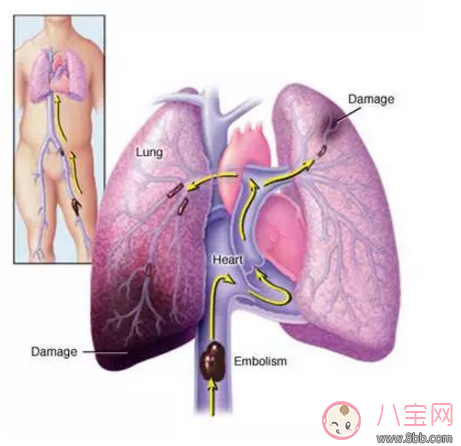 產(chǎn)后媽媽20天只吃不動(dòng)好不好 新媽媽坐月子不活動(dòng)有什么危害 產(chǎn)后媽媽20天只吃不動(dòng)好不好 新媽媽坐月子不活動(dòng)有什么危害