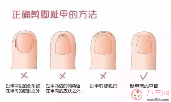 坐月子的時候可以給孩子剪指甲嗎 孩子的腳趾甲怎么剪好