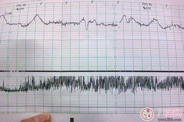 懷孕12周胎心率170有危險(xiǎn)嗎 準(zhǔn)媽媽怎么控制胎心率