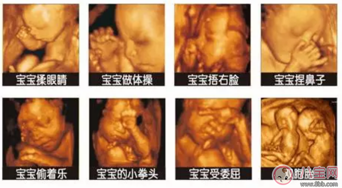 四維彩超多少錢 四維彩超檢查報(bào)告怎么看