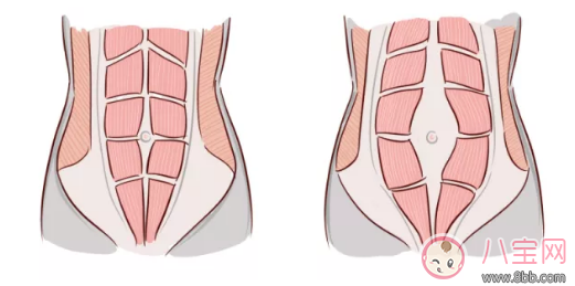 產(chǎn)后腹肌分離怎么恢復(fù) 怎么讓自己的小腹恢復(fù)到從前那樣