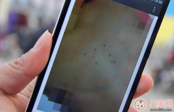 小孩皮膚被針扎了的針眼圖片 怎么判斷小孩皮膚是否被針扎了