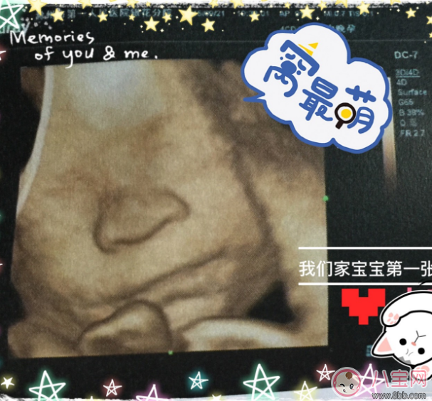 怎么在朋友圈公布自己懷孕了 公布懷孕的朋友圈說(shuō)說(shuō)怎么發(fā) 怎么在朋友圈公布自己懷孕了 公布懷孕的朋友圈說(shuō)說(shuō)怎么發(fā)