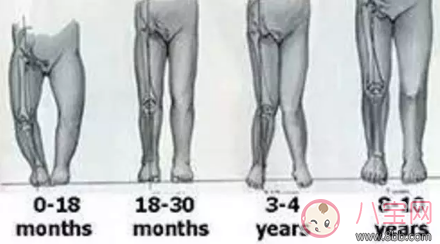 寶寶O型腿是因為缺鈣嗎 寶寶腿型是O的要不要補鈣