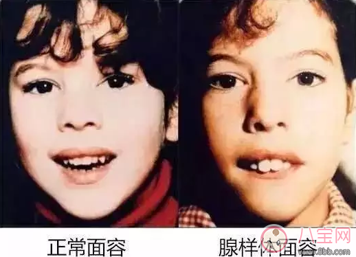 孩子晚上睡覺打鼾怎么辦 孩子睡覺打鼾對他的成長有什么影響