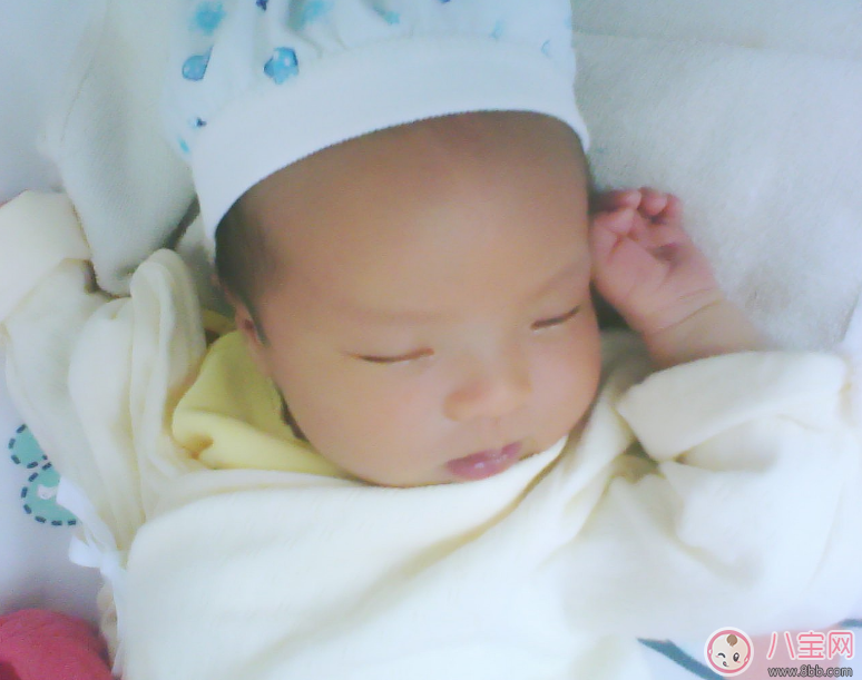 寶寶黃疸怎么處理 寶寶黃疸可以吃茵梔黃嗎