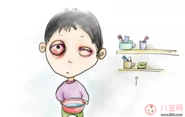 寶寶白眼球發(fā)紅能用眼藥水嗎 寶寶白眼球發(fā)紅是什么原因 寶寶白眼球發(fā)紅能用眼藥水嗎 寶寶白眼球發(fā)紅是什么原因