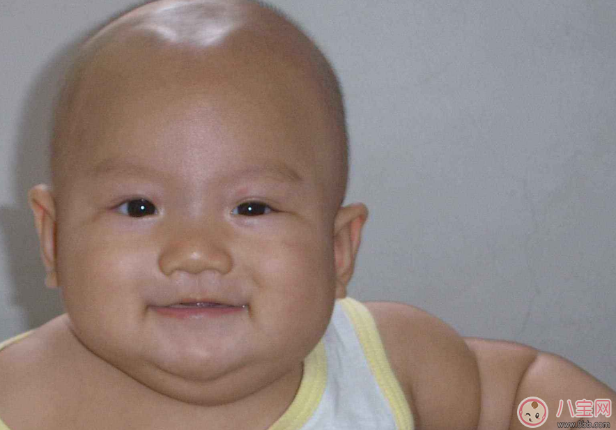 寶寶三個(gè)月出門要遮囟門嗎 寶寶囟門怎么進(jìn)行保護(hù)