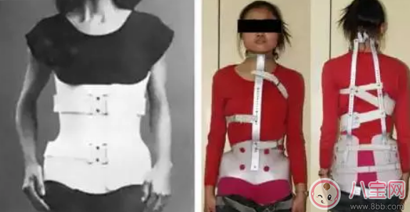 孩子高低肩膀駝背含胸怎么辦   如何預防孩子脊椎側彎