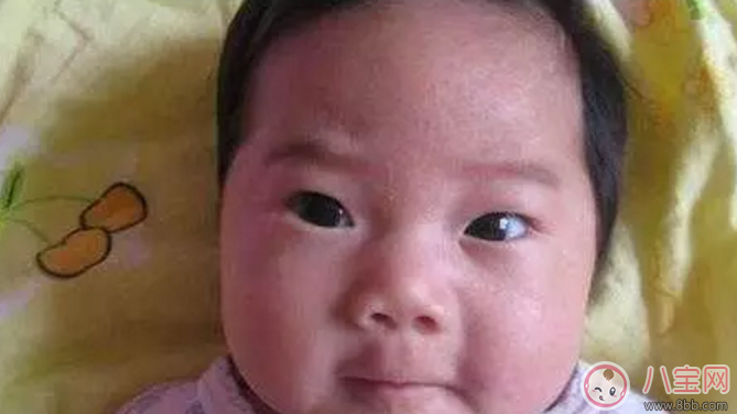 寶寶睡覺候喜歡抓頭怎么辦 寶寶睡覺喜歡抓頭是什么疾病 寶寶睡覺候喜歡抓頭怎么辦 寶寶睡覺喜歡抓頭是什么疾病