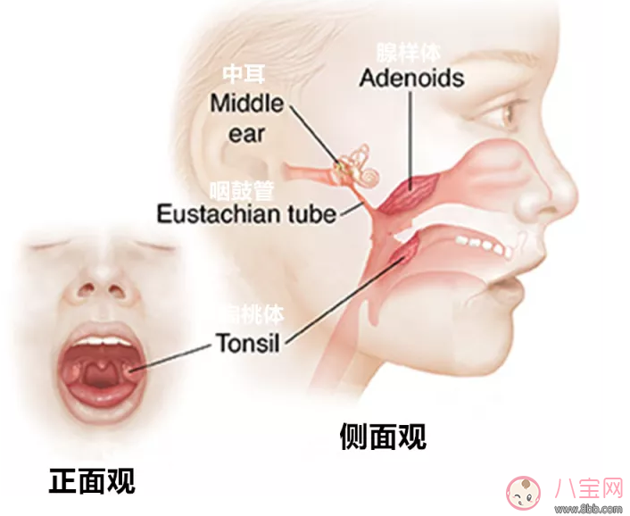 孩子喜歡打鼾是不是因為扁桃體發炎 孩子扁桃體發炎怎么辦 孩子喜歡打鼾是不是因為扁桃體發炎 孩子扁桃體發炎怎么辦