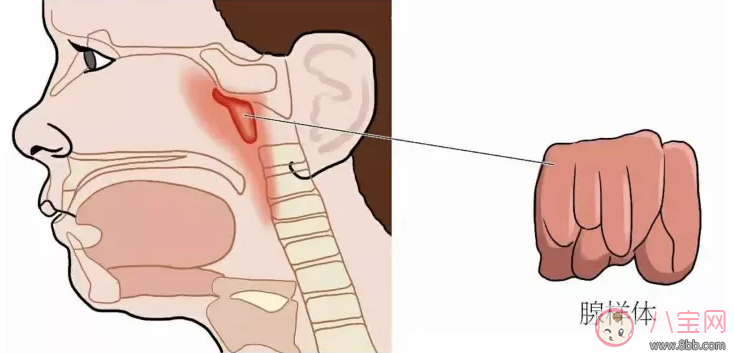 孩子喜歡打鼾是不是因為扁桃體發炎 孩子扁桃體發炎怎么辦 孩子喜歡打鼾是不是因為扁桃體發炎 孩子扁桃體發炎怎么辦