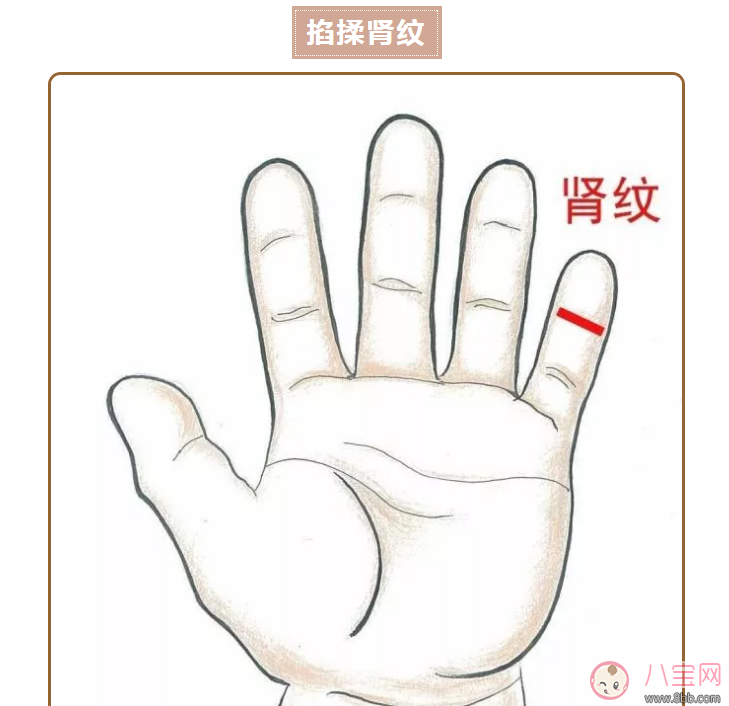 寶寶尿床推拿圖解手法 推拿治療小兒尿床的方法