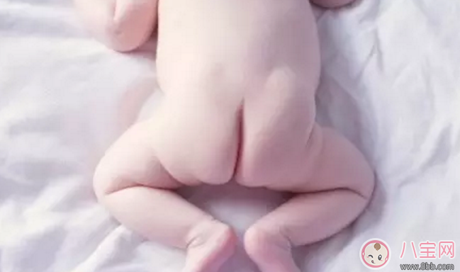 寶寶肛門特別紅是上火了嗎 寶寶屁股顏色深是什么原因