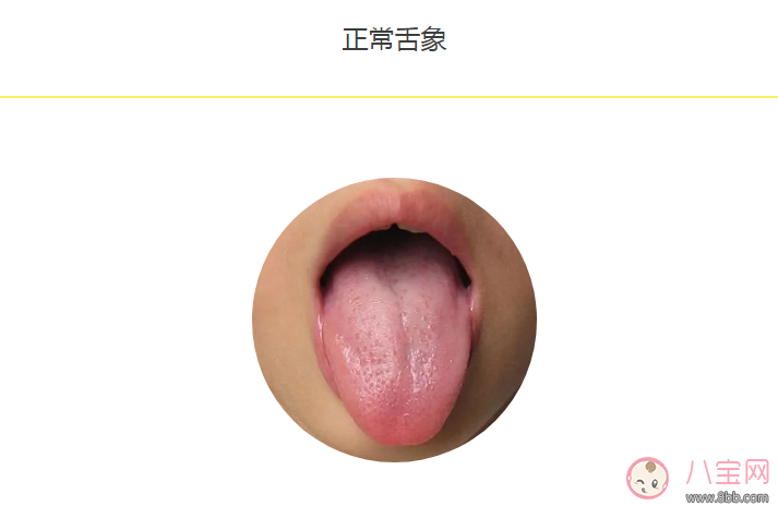 寶寶積食感冒舌頭圖片 怎么看寶寶是不是積食感冒有哪些癥狀