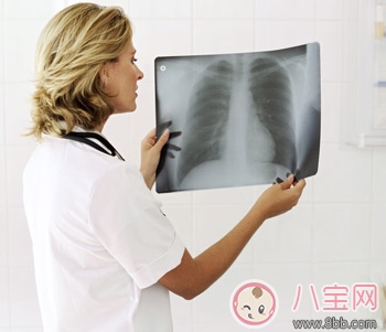  胸透對胎兒有影響嗎 胸透會使胎兒畸形是不是真的
