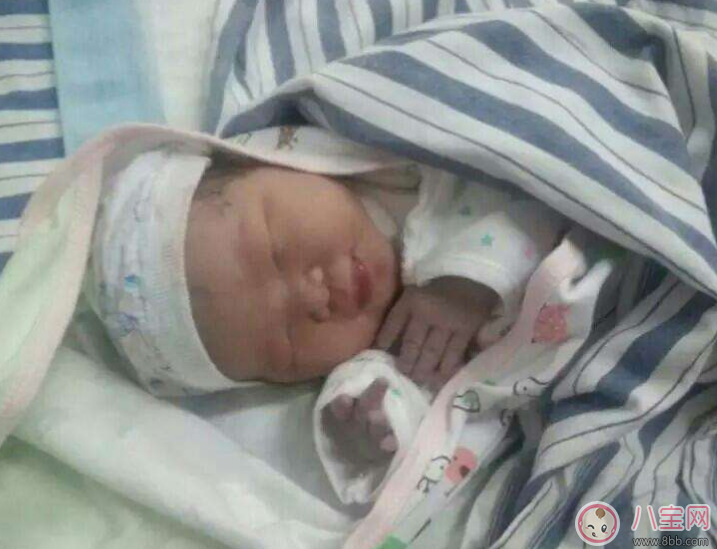 孕幾周的時(shí)候進(jìn)行剖腹產(chǎn)手術(shù)比較好 剖腹產(chǎn)什么時(shí)候最疼 孕幾周的時(shí)候進(jìn)行剖腹產(chǎn)手術(shù)比較好 剖腹產(chǎn)什么時(shí)候最疼