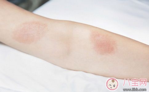 女性艾滋病初期癥狀  帶安全套會(huì)得艾滋病嗎