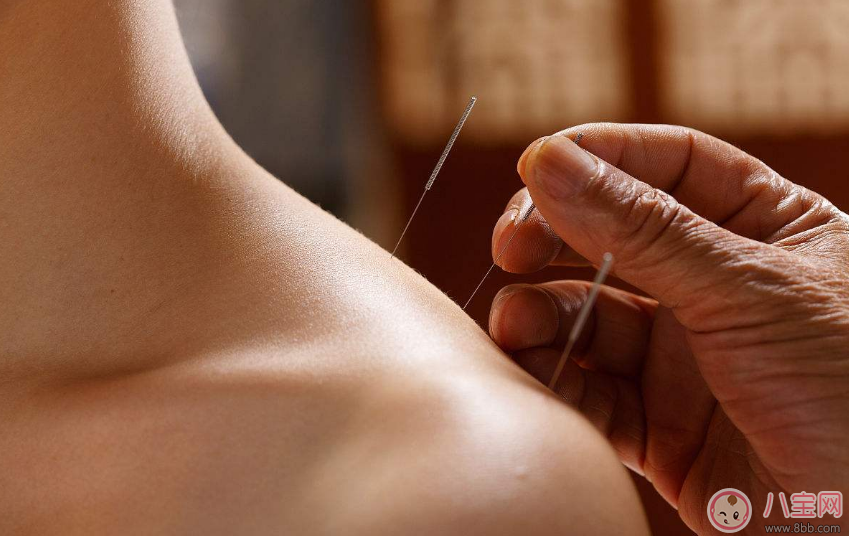 懷孕初期能做針灸嗎 懷孕做針灸會(huì)怎么樣 懷孕初期能做針灸嗎 懷孕做針灸會(huì)怎么樣