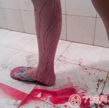 女性最多能有幾次流產 藥流和人工流產的區別在哪 女性最多能有幾次流產 藥流和人工流產的區別在哪