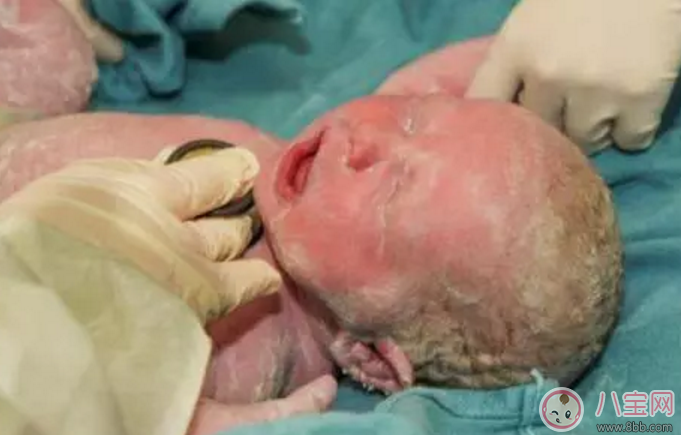 為什么寶寶剛出生就哭 2018寶寶剛出生就哭有哪些說法