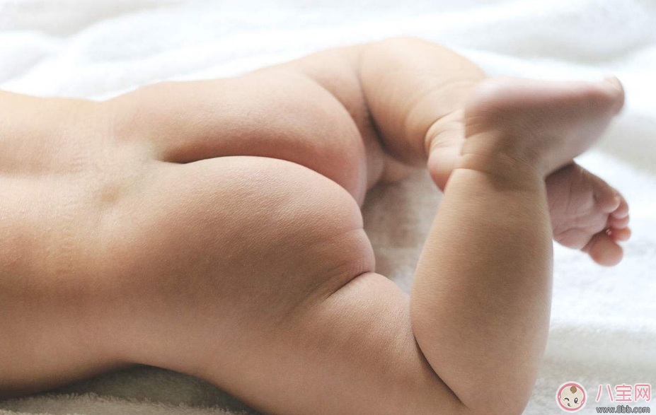 經常換紙尿褲還是會紅屁屁是什么原因 勤換紙尿褲紅屁屁是紙尿褲的原因嗎