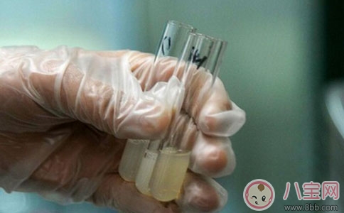 弱精癥的癥狀有哪些 弱精癥的治療方法 弱精癥的癥狀有哪些 弱精癥的治療方法