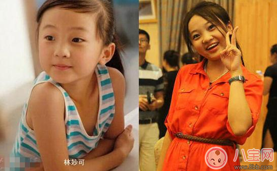 怎么避免孩子長大以后長殘了 孩子小時(shí)候好看長大變丑怎么辦 怎么避免孩子長大以后長殘了 孩子小時(shí)候好看長大變丑怎么辦