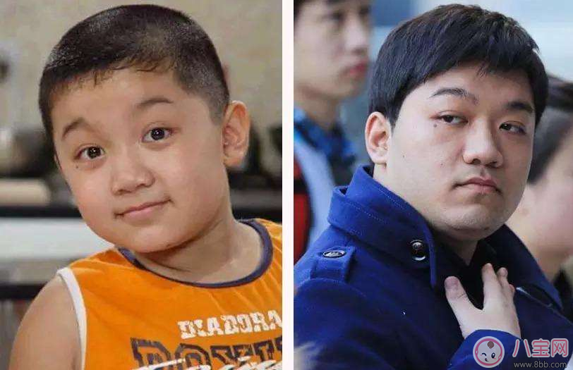 怎么避免孩子長大以后長殘了 孩子小時(shí)候好看長大變丑怎么辦 怎么避免孩子長大以后長殘了 孩子小時(shí)候好看長大變丑怎么辦