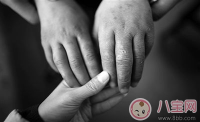 孩子凍瘡早期的治理方法是什么 孩子凍瘡的預防措施有哪些 孩子凍瘡早期的治理方法是什么 孩子凍瘡的預防措施有哪些