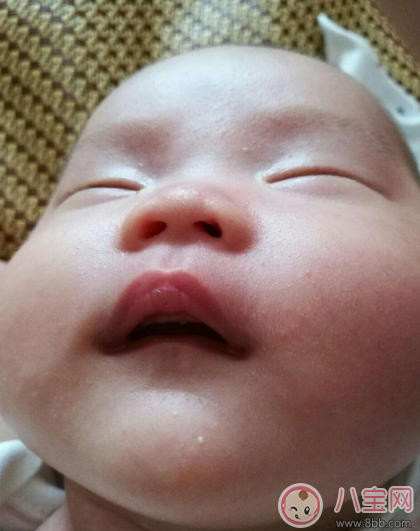 孩子嘴角潮紅經常舔嘴巴是什么原因 孩子舔嘴巴是口角炎嗎