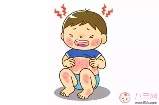 寶寶濕疹最佳治療方法 寶寶濕疹是怎么引起的 寶寶濕疹最佳治療方法 寶寶濕疹是怎么引起的