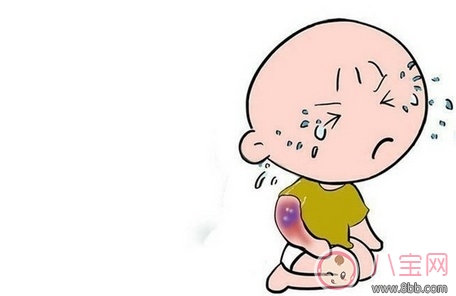 寶寶燙傷用什么藥好 寶寶燙傷應該怎么辦 寶寶燙傷用什么藥好 寶寶燙傷應該怎么辦