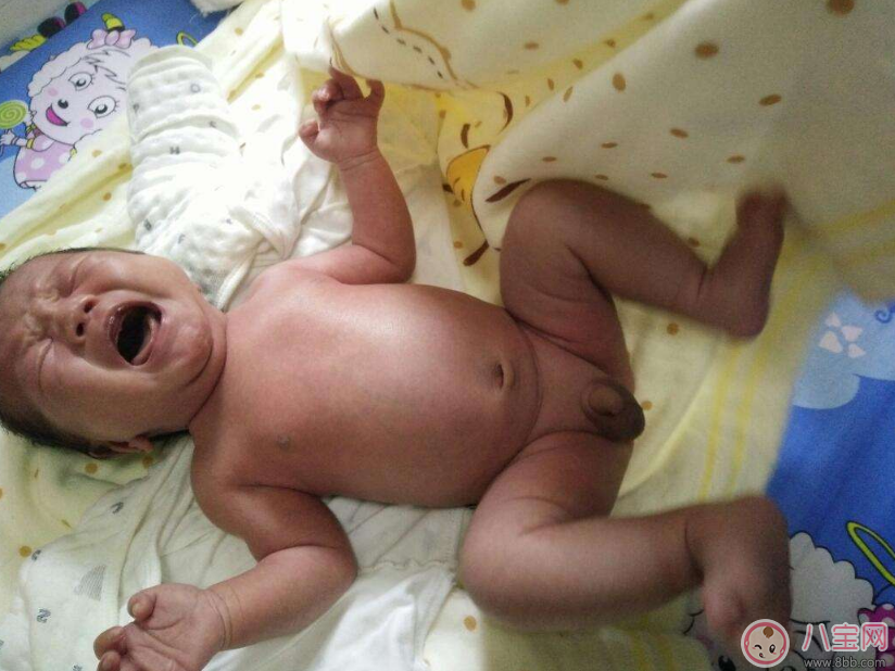 預產期到了沒生怎么辦 預產期到了沒生需要催產嗎