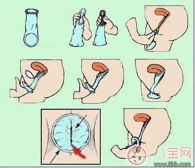 女用避孕套使用方法演示 女用避孕套為什么不受歡迎 女用避孕套使用方法演示 女用避孕套為什么不受歡迎