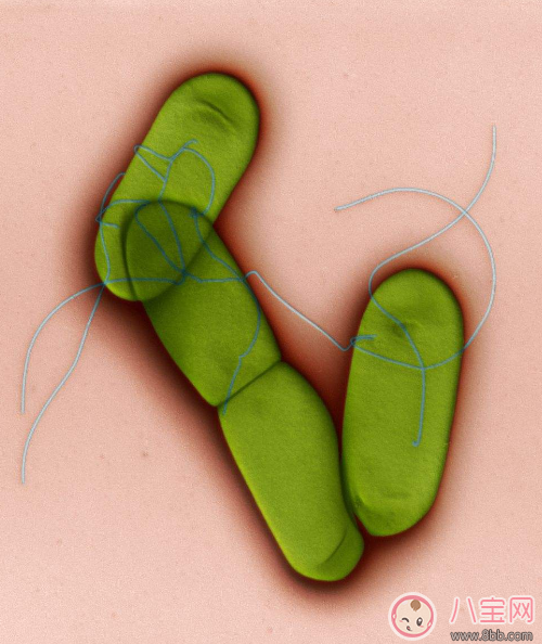 李斯特菌病感染癥狀是什么 李斯特菌病能治好嗎 李斯特菌病感染癥狀是什么 李斯特菌病能治好嗎