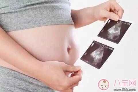 準爸爸需要吃葉酸嗎  準爸爸與準媽媽補充劑量一樣嗎