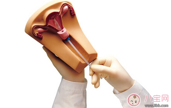 節育環什么時候需要取 節育環什么時候取環最合適 節育環什么時候需要取 節育環什么時候取環最合適