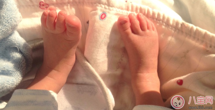 孩子黃疸曬太陽曬多久 寶寶黃疸曬太陽怎么曬好