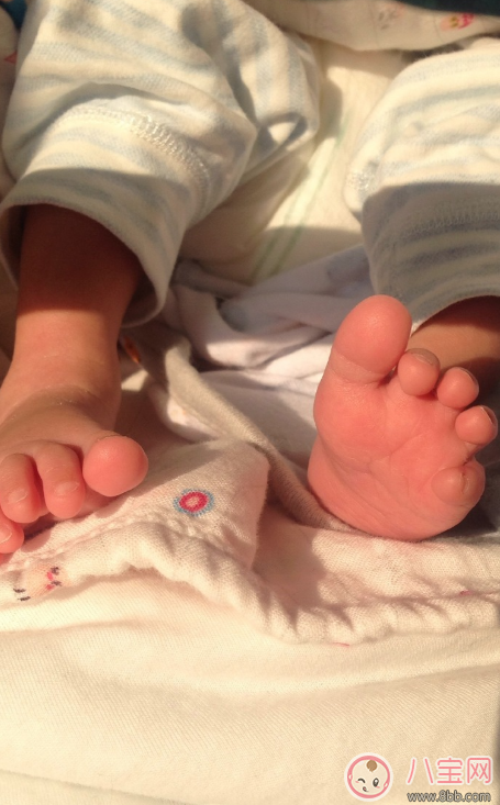 孩子黃疸曬太陽曬多久 寶寶黃疸曬太陽怎么曬好