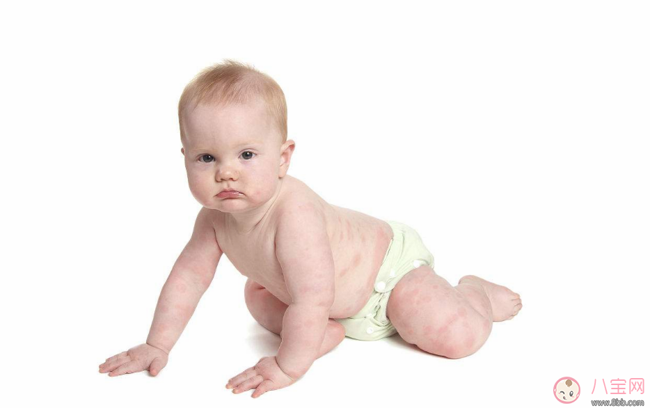 三歲寶寶積食吃什么好   寶寶積食后如何飲食調(diào)理