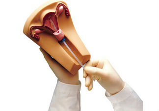 節(jié)育環(huán)什么時(shí)候需要取 節(jié)育環(huán)什么時(shí)候取環(huán)最合適